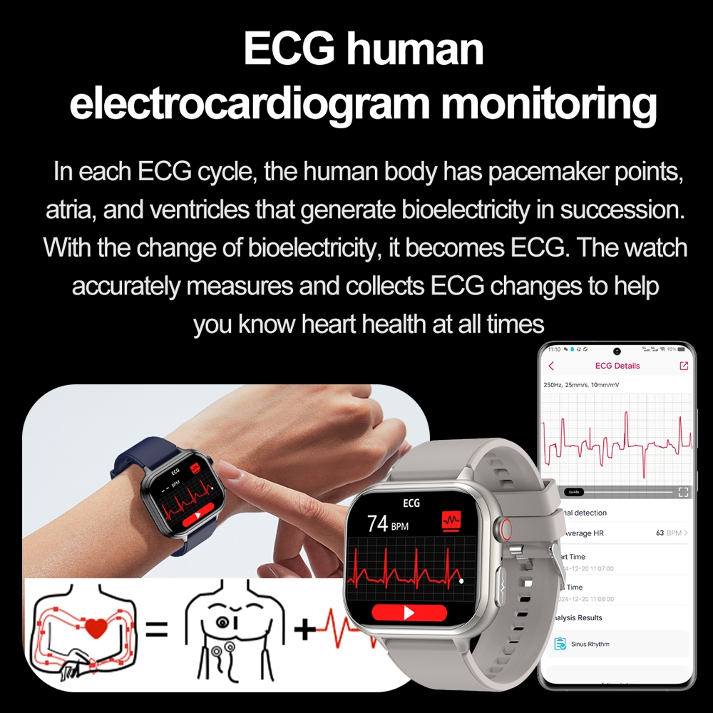 2026 New Health Analytics Smar - Smartwatch Health Watches For Women 评论和价格